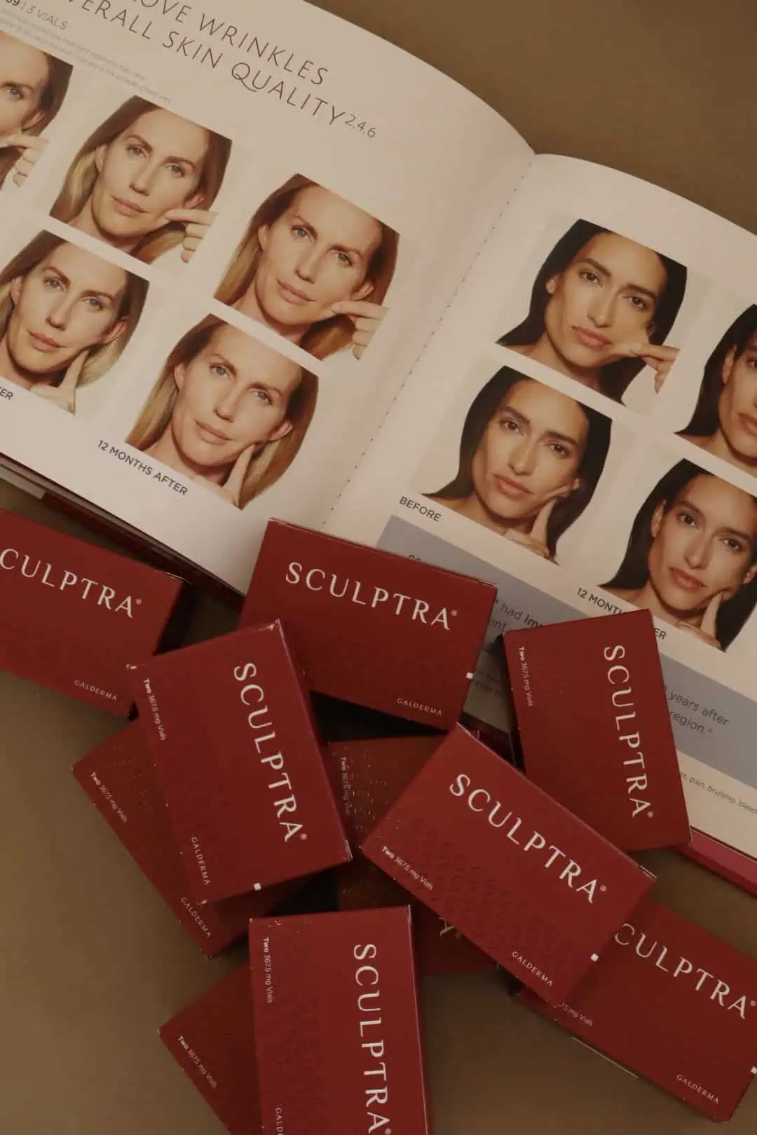 Biostimulators by verla aesthetics | Sculptra® & Radiesse® (Biostimulators)