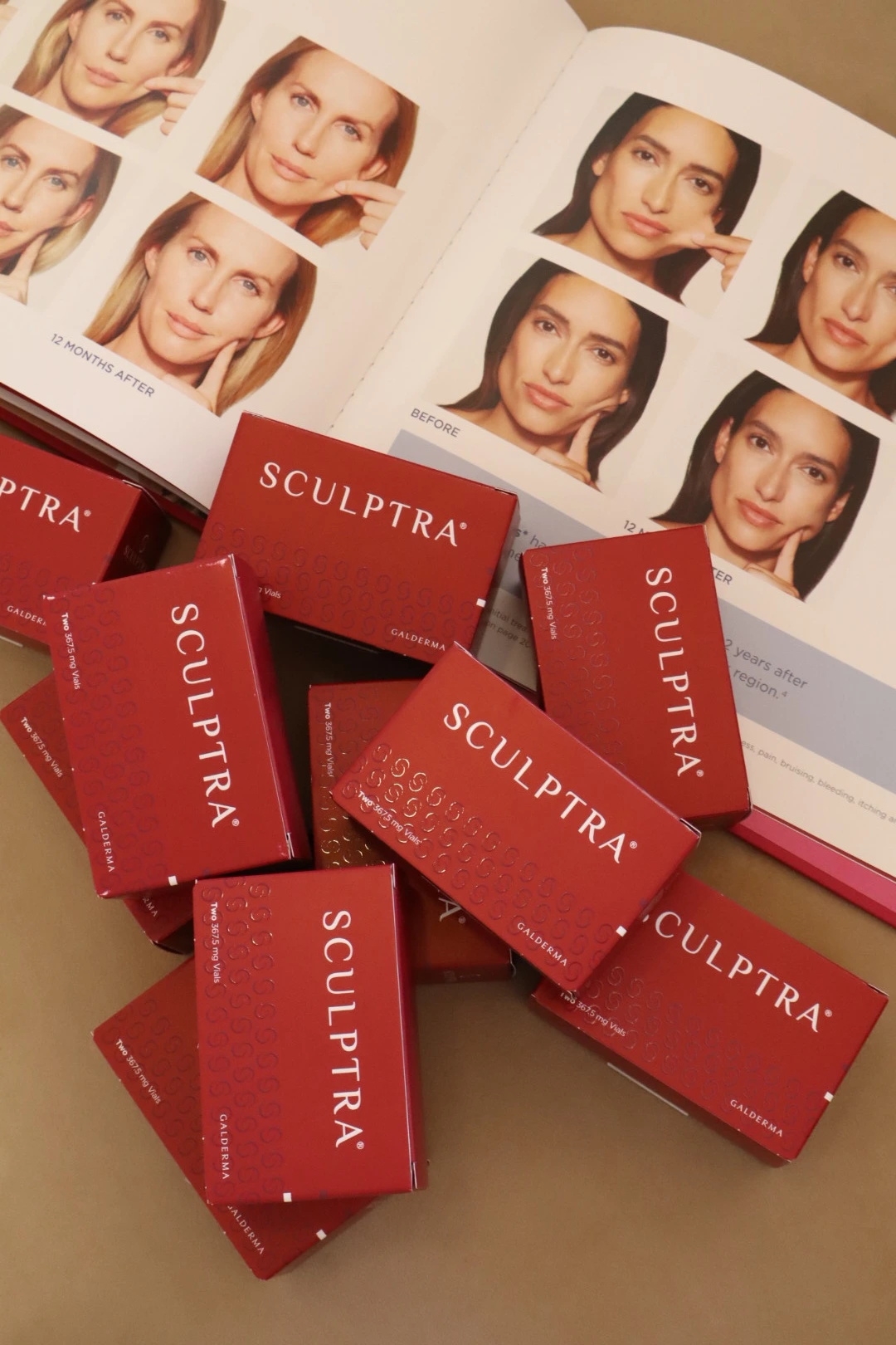 Sculptra | Sculptra® & Radiesse® (Biostimulators)