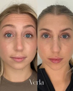 Before and after Image1 | Before and After