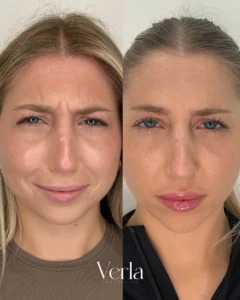Before and after Image2 | Before and After