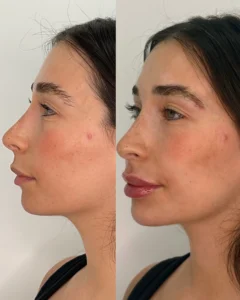 Before and after Image3 | Before and After