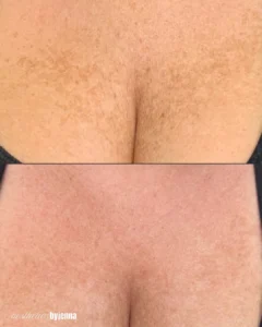 Before and after Image4 | Before and After