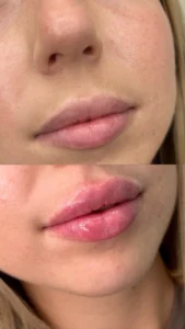 Before and after Image5 | Before and After