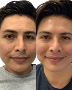Before and after Image7 | Before and After