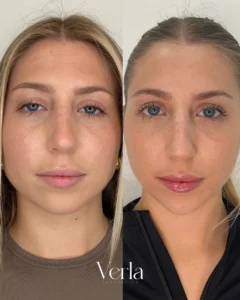 Before and after Image8 | Before and After