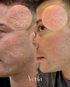 F87B890B 02BF 420C A46B 2F98E4CC0CF3 | Before and After