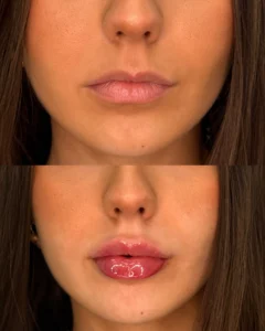 Facetune 09 06 2025 17 26 56 | Before and After