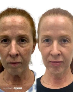before and after image | Before and After