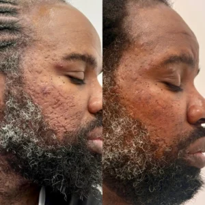 before after | Before and After