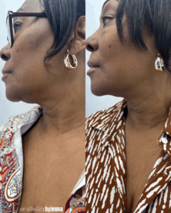 that work | Before and After