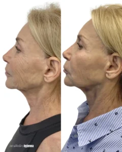 that work | Before and After