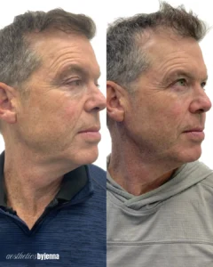 that work. 2 | Before and After