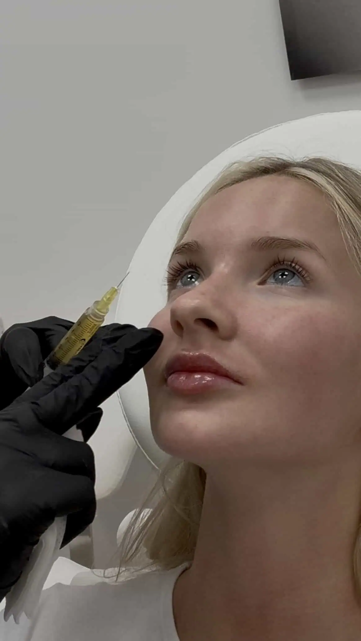 PRP Injections by verla aesthetics | PRP Injections in North Miami, FL