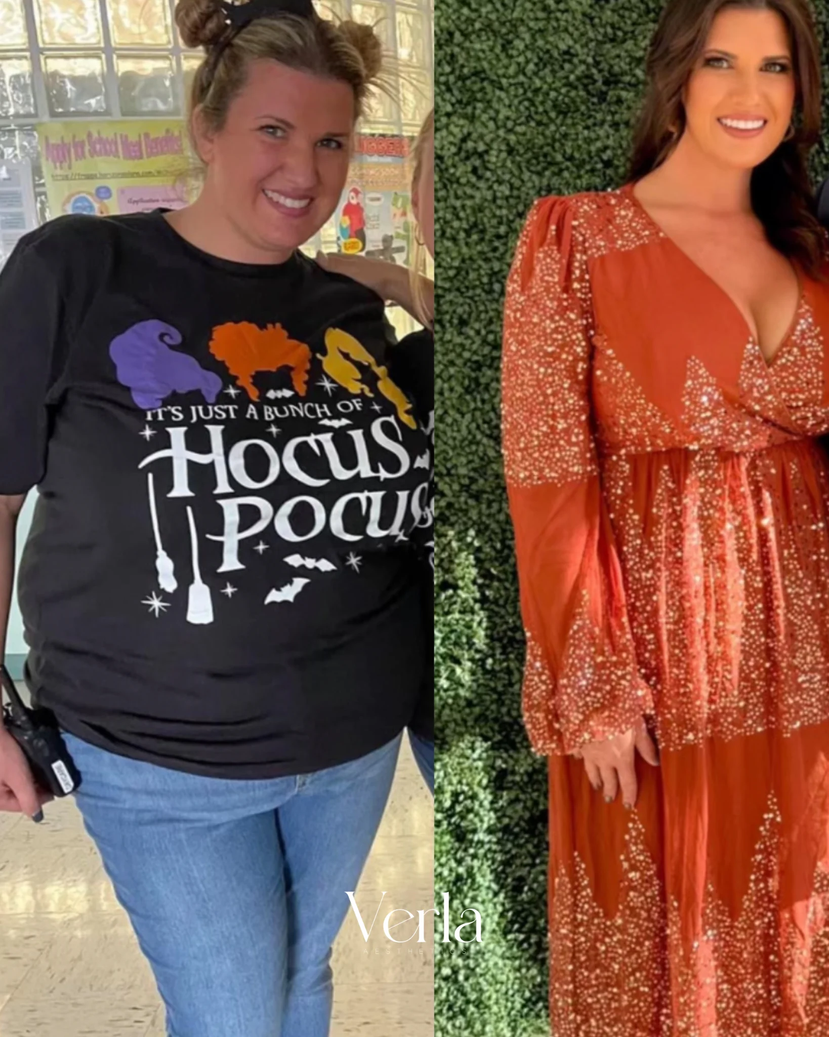 Medical Weight Loss Program 9 months | Before and After