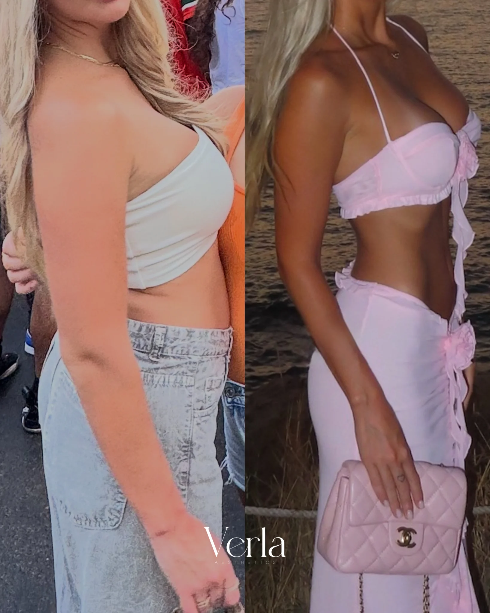 Medical Weight Loss Program 9 months 1 | Before and After