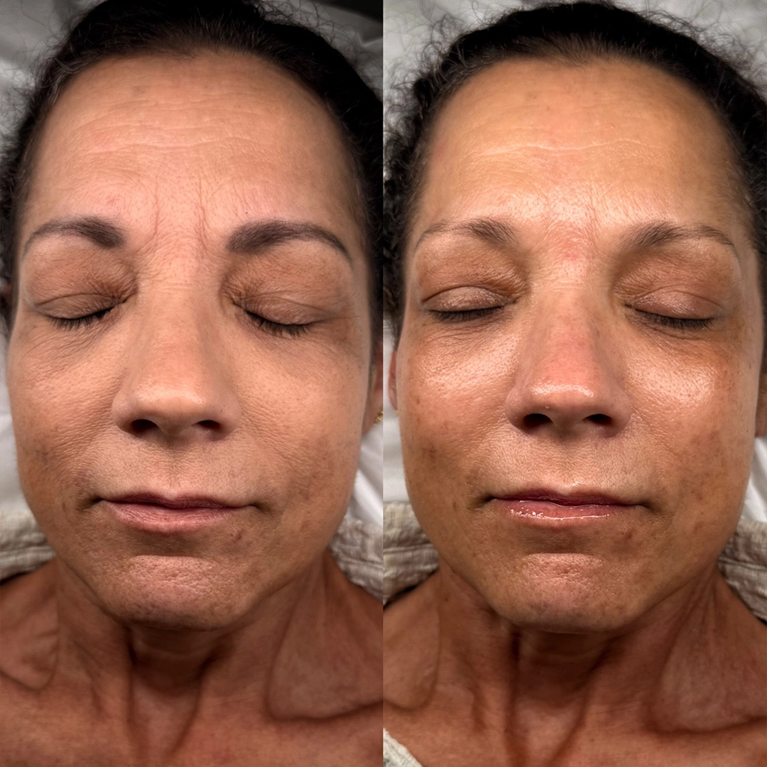 Customized Facials 2 Customise Facial Before & After 1