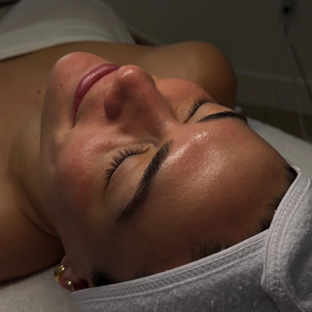 Customized Facials 4 Customise-Facial-Before-After-2