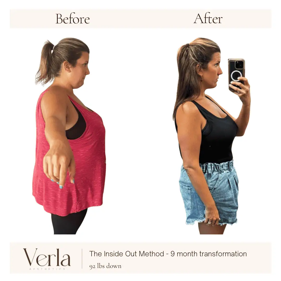 Home 10 Verla Before & After 10