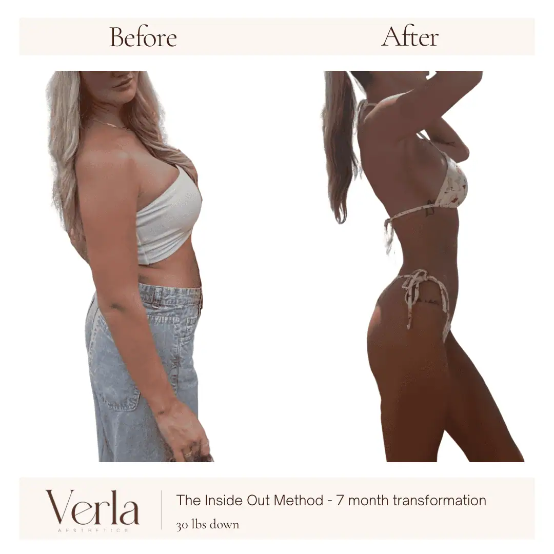 Home 18 Verla Before & After 18