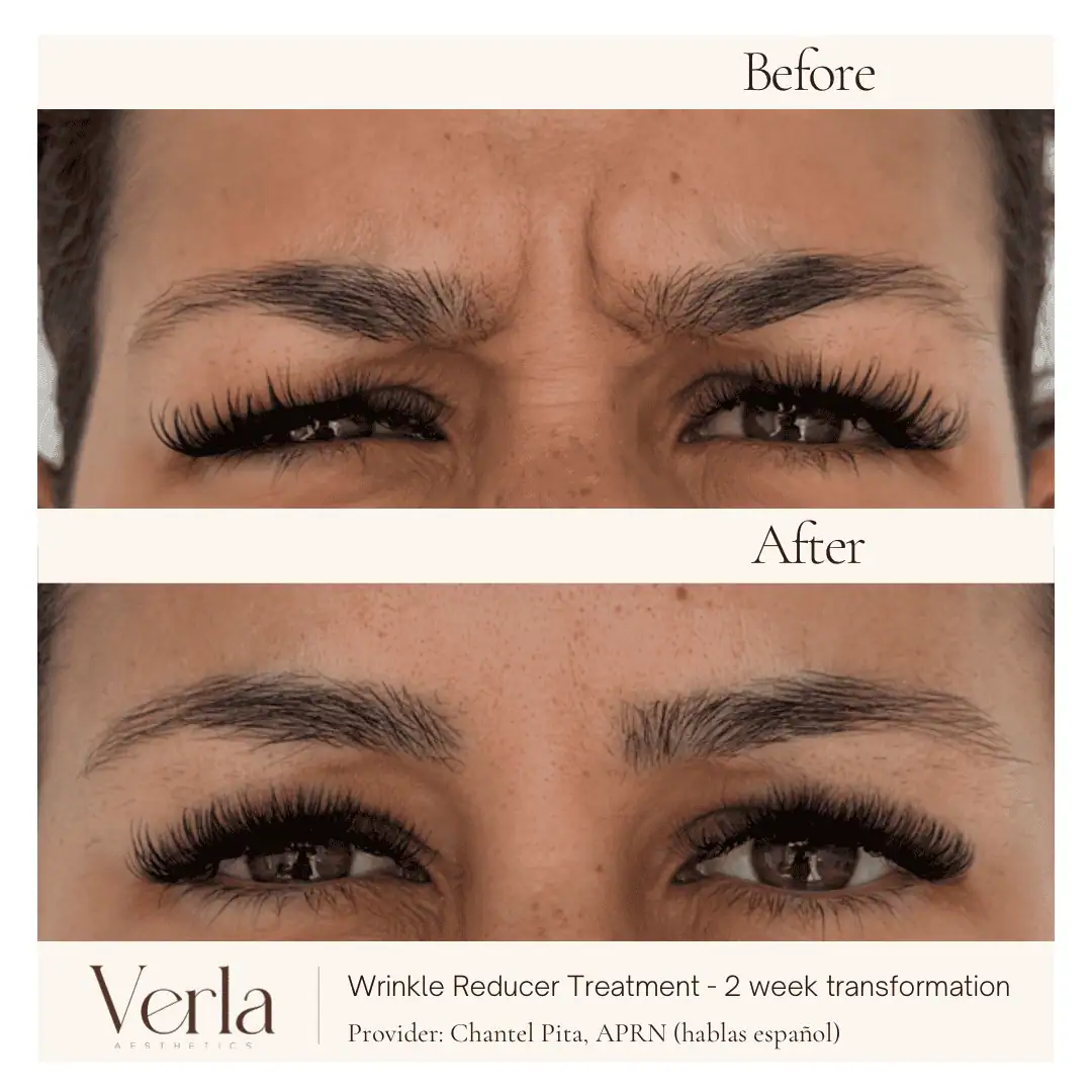 Home 19 Verla Before & After 19