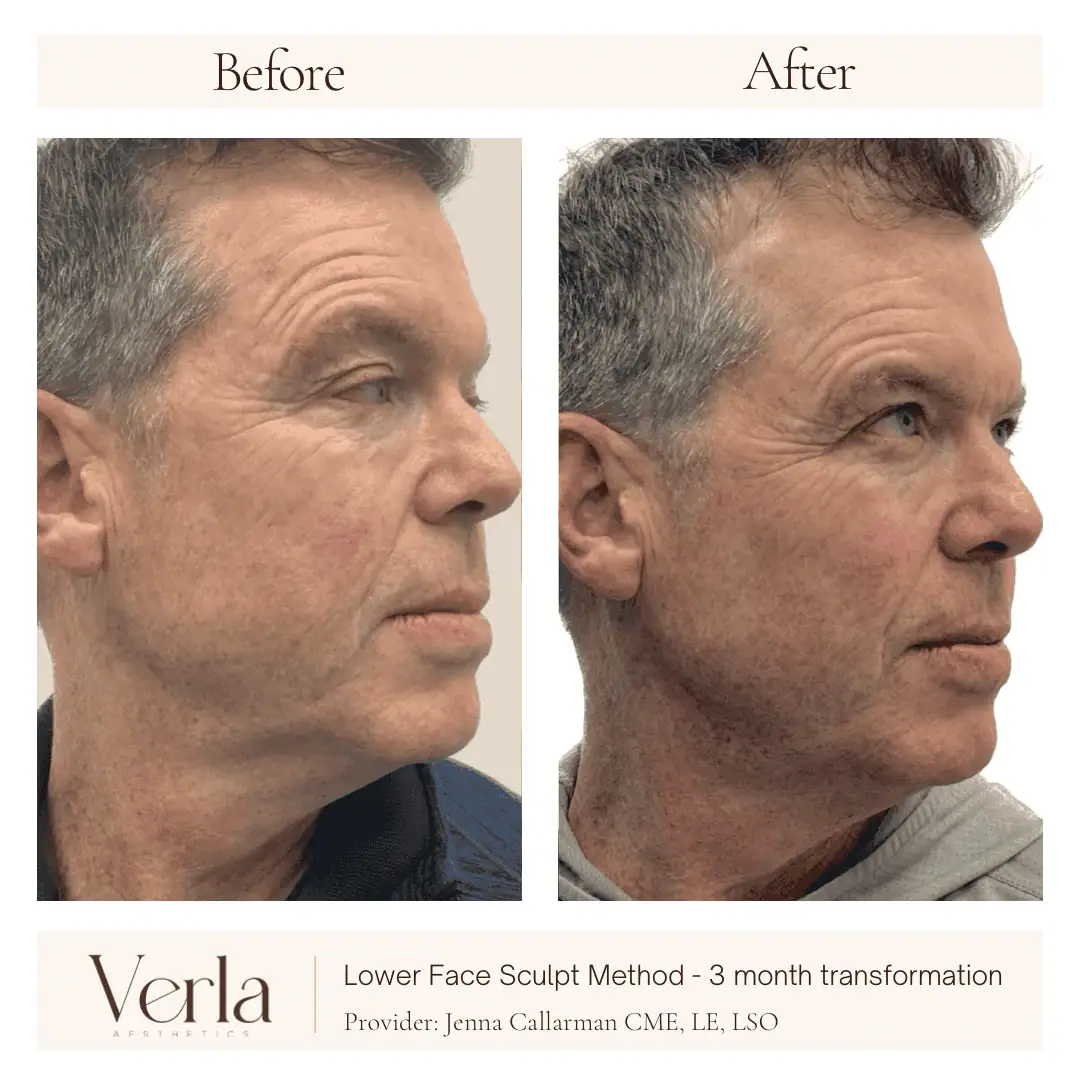 Home 3 Verla Before & After 3