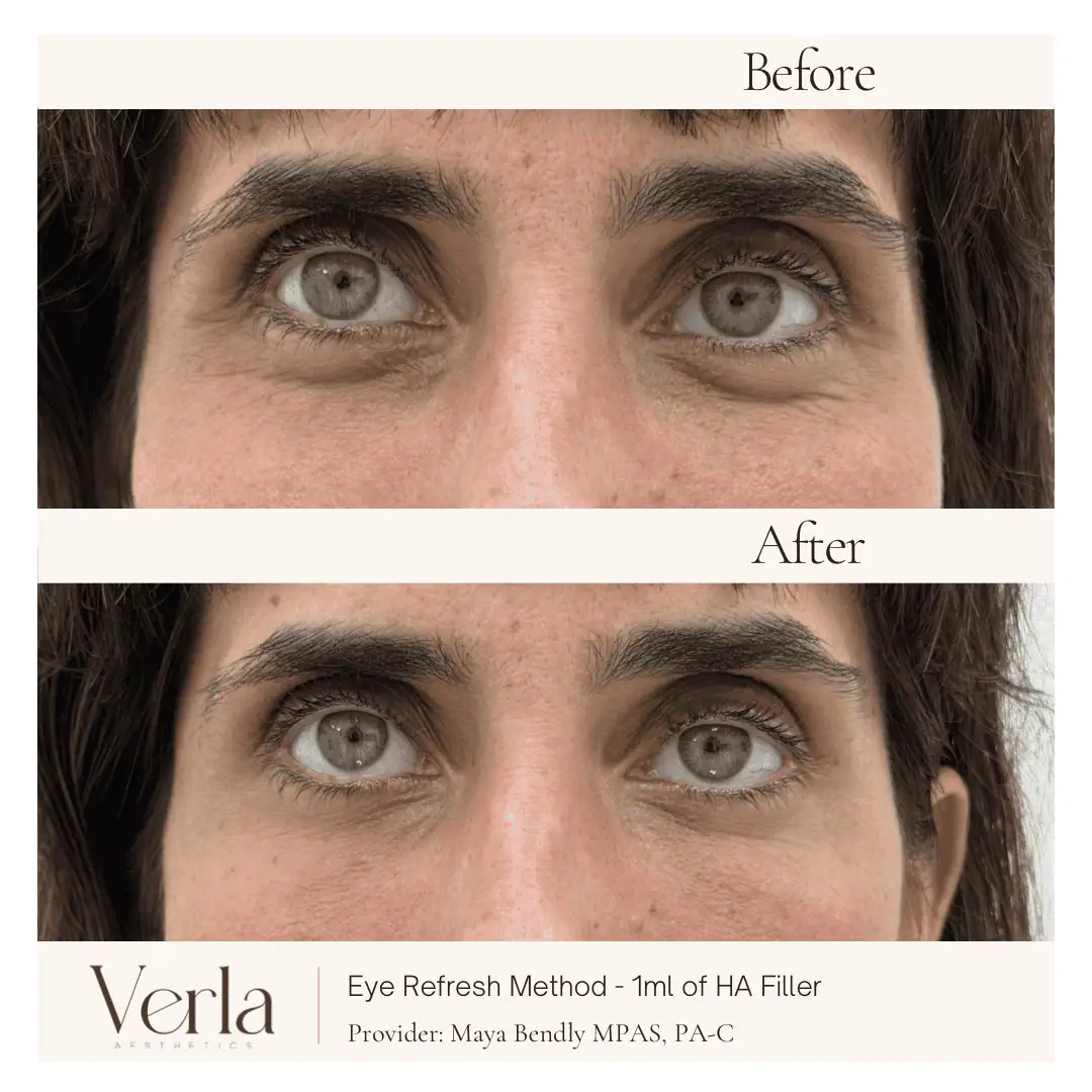 Home 6 Verla Before & After 6