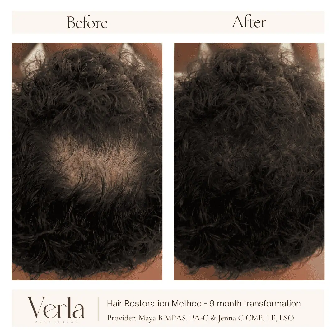 Home 7 Verla Before & After 7