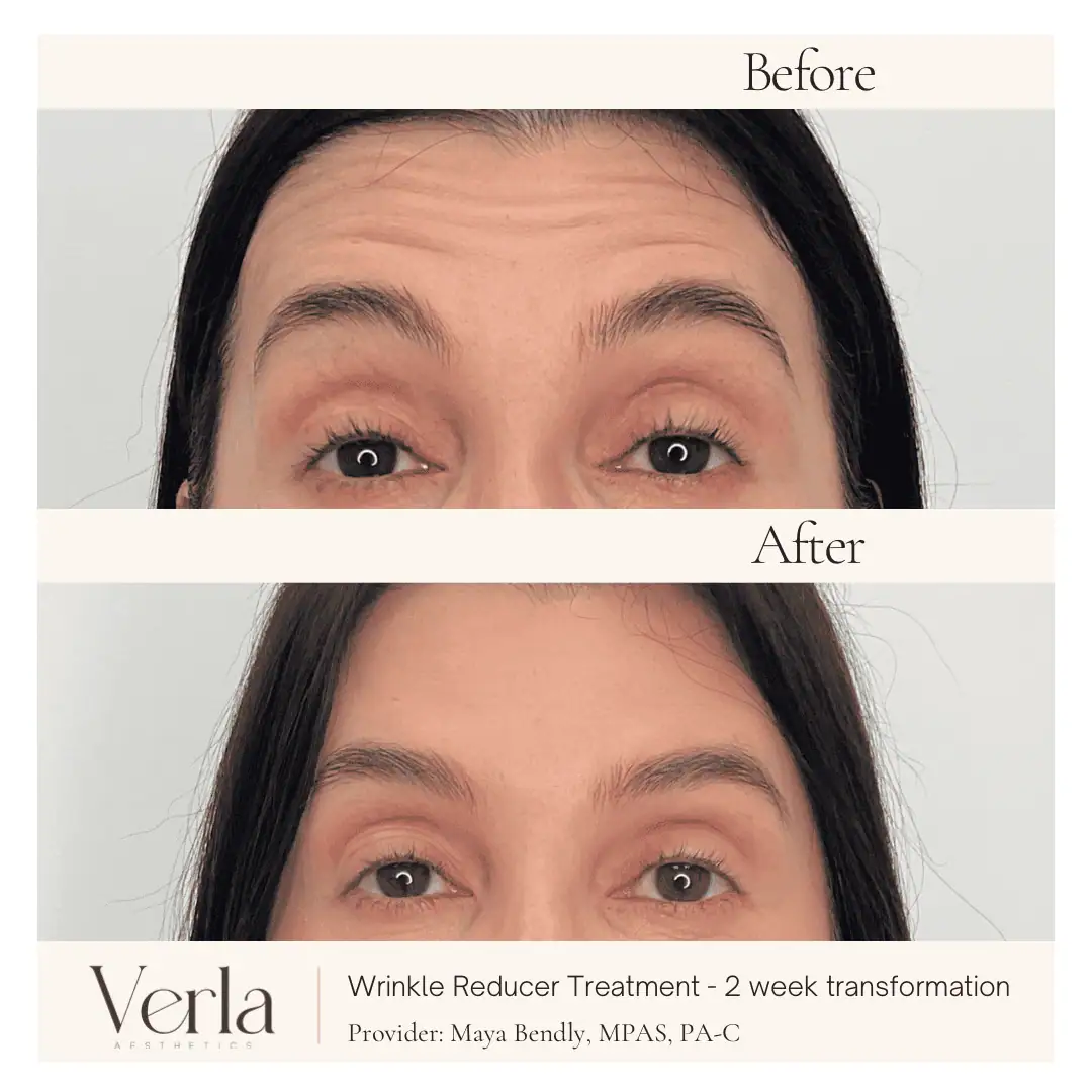 Home 8 Verla Before & After 8