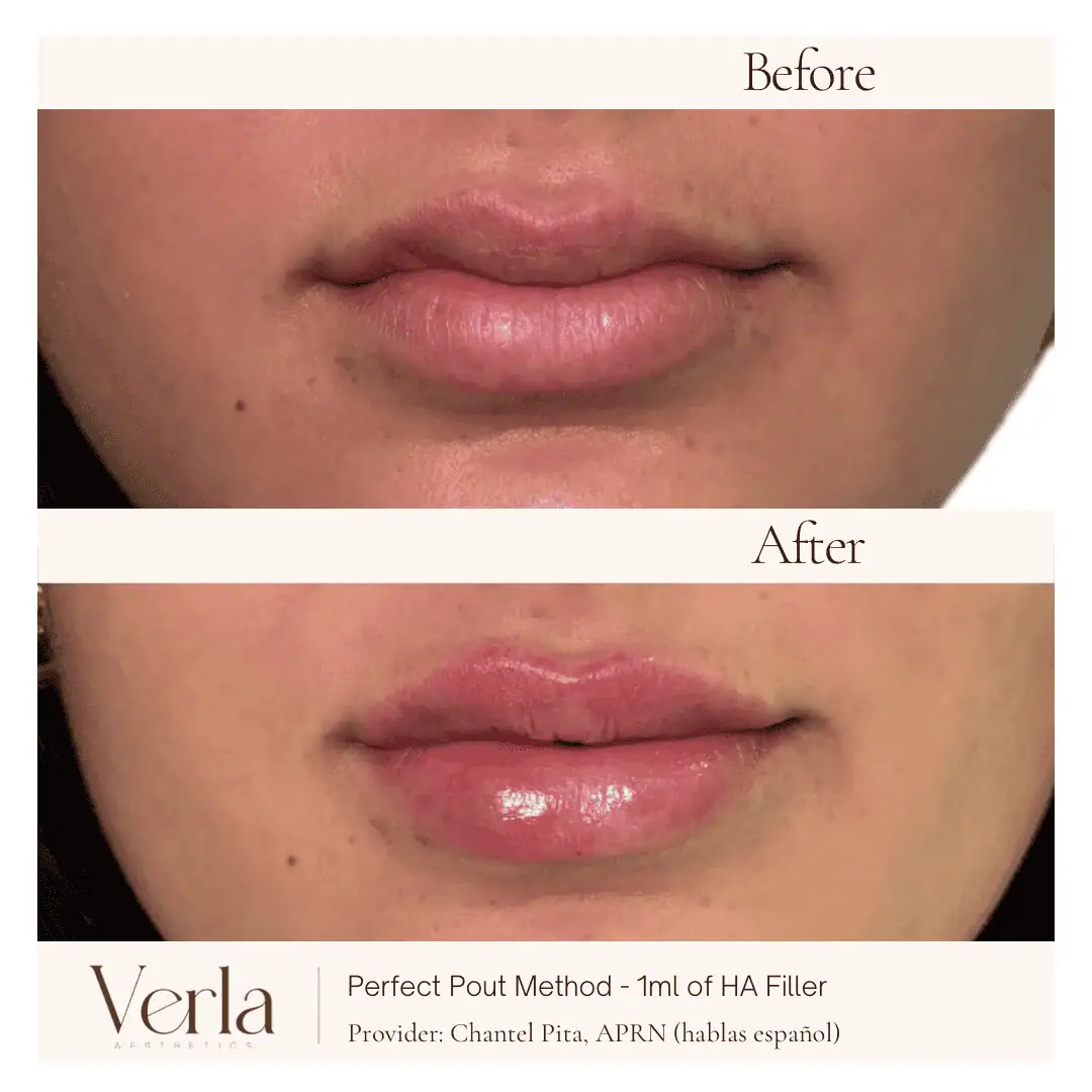 Home 9 Verla Before & After 9